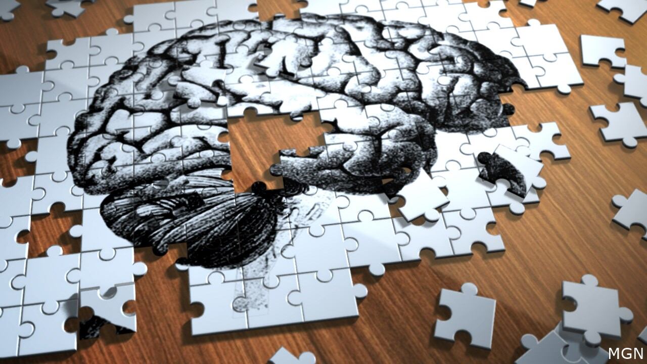 Alzheimer's takes financial toll before being diagnosed, study says - Vimarsana News